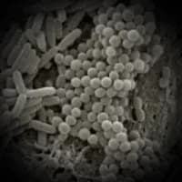 Bacteria
